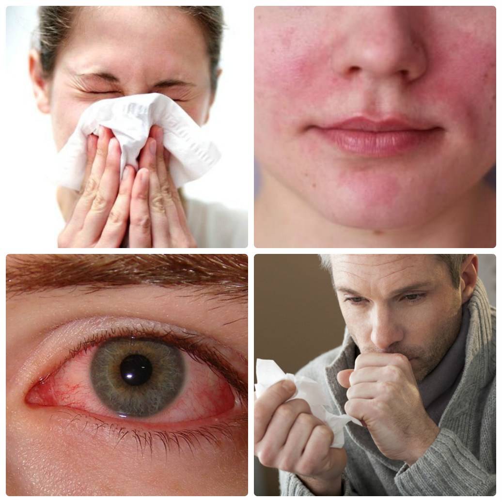 Аллергия на линзы и откуда она может появиться