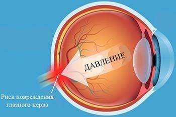 Глазное давление - норма в 30, 40, 50, 60 лет, причины отклонений