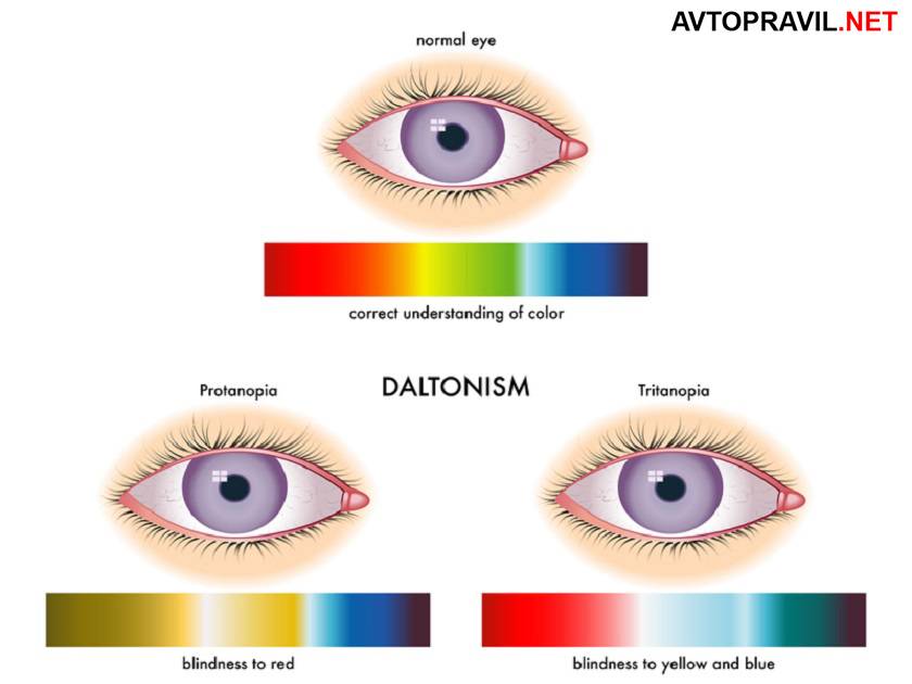 Астенопия что это за болезнь. что нужно знать о  астенопии. — офтальмология