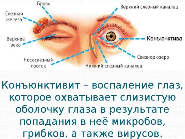 Болит верхнее веко: причины, симптомы, методы лечения - "здоровое око"