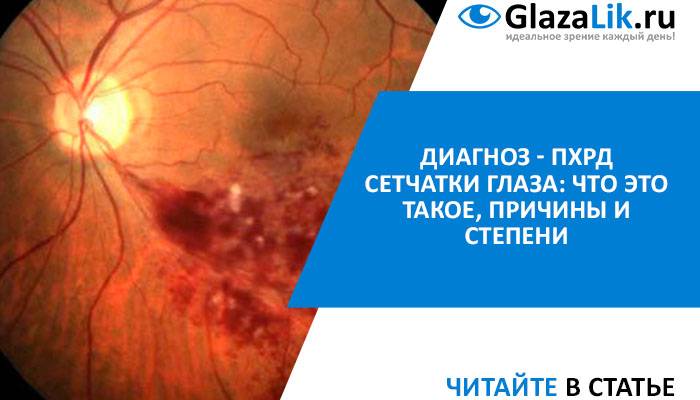Дистрофия сетчатки глаза: как лечить - "здоровое око"