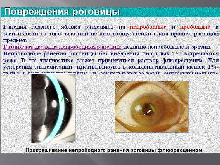 Ушиб глаза: симптомы, первая помощь, способы лечения