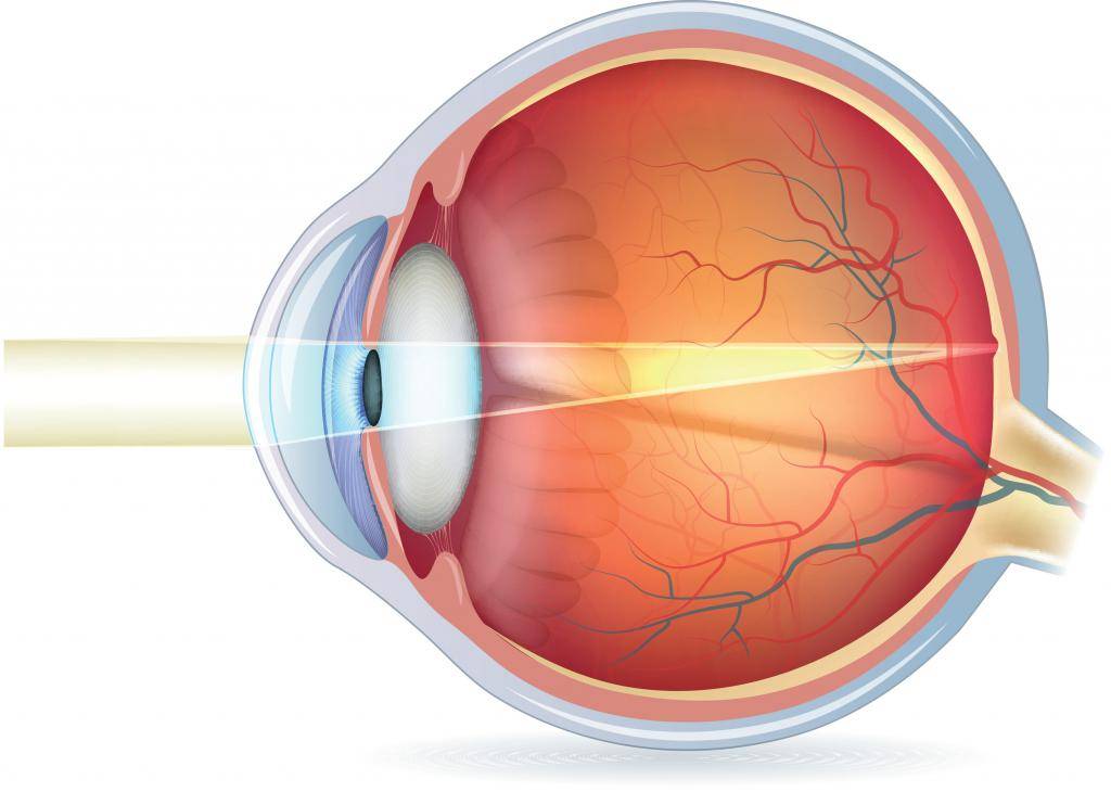 Рефрактометрия глаза, типы рефракции, особенности диагностики