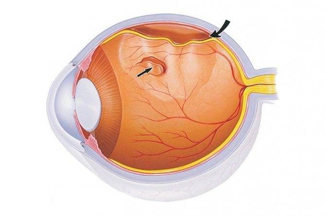 Компьютерная томография сетчатки глаза: что это, когда назначают, расшифровка результатов