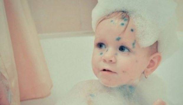 Можно ли купать ребенка при конъюнктивите, как мыть малыша правильно, противопоказания и ограничения