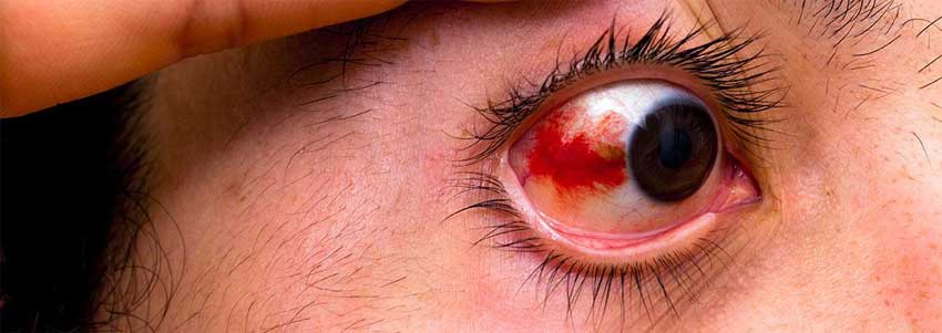 Нистагм глазного яблока: что это такое, причины возникновения и виды патологии, диагностика и лечение