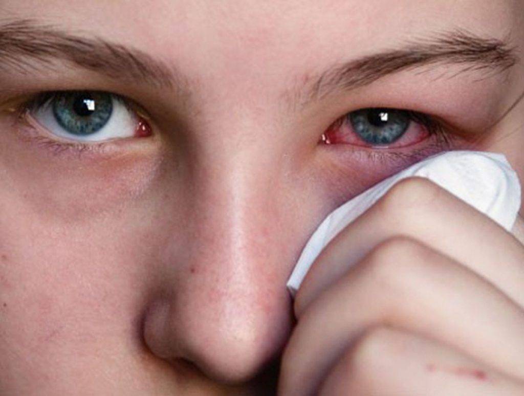 Болят глаза у ребенка при температуре - причины, что делать