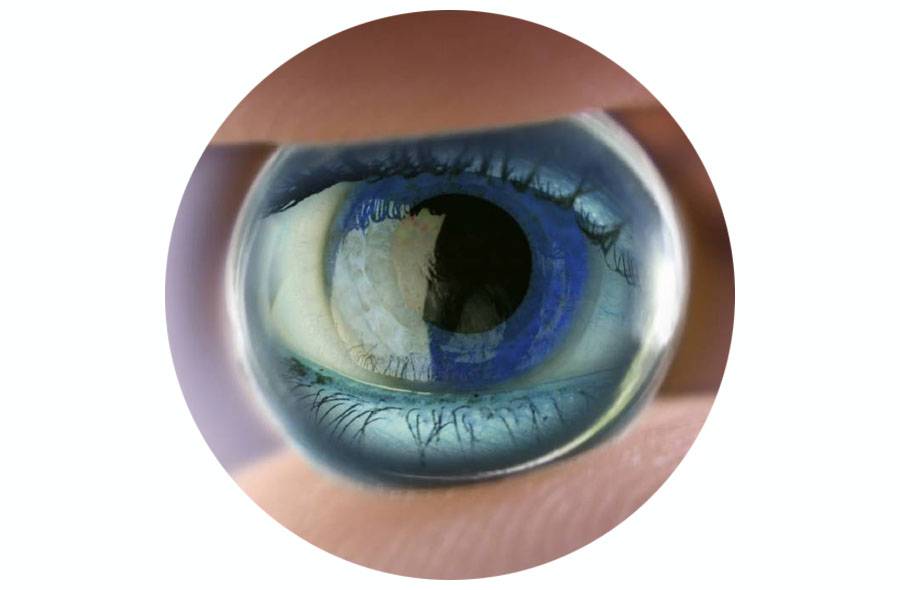 Ночные ортокератологические линзы для глаз