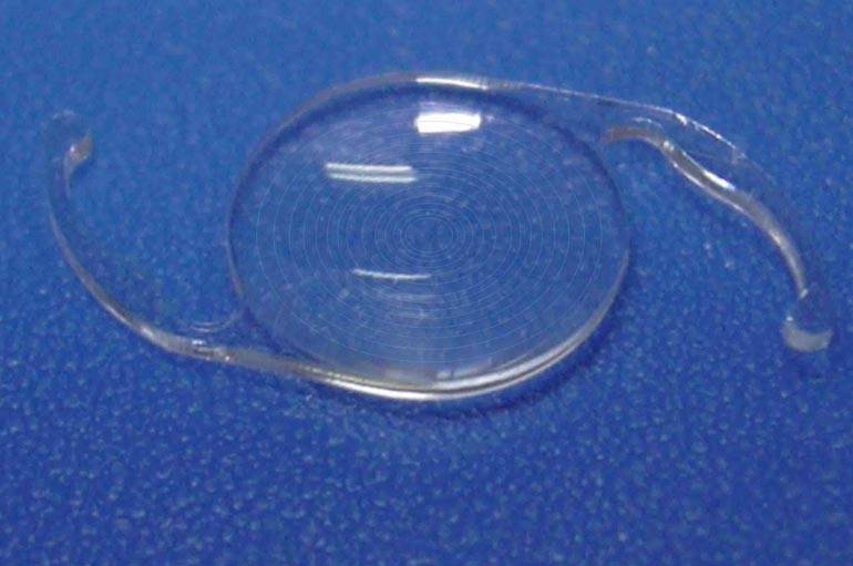 Немецкие искусственные хрусталики для глаз (иол, интраокулярные линзы)