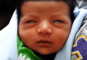 Почему ребенок закатывает глаза вверх 9 месяцев. что делать, когда у младенца закатываются глаза