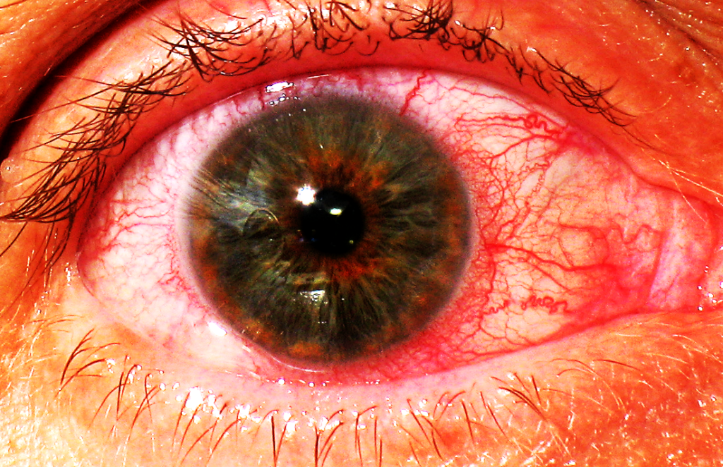 Болят и краснеют глаза от компьютера: что делать для их защиты