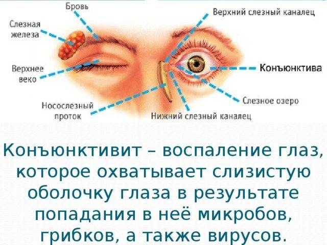 Боль в левом глазу: причины и лечение - "здоровое око"