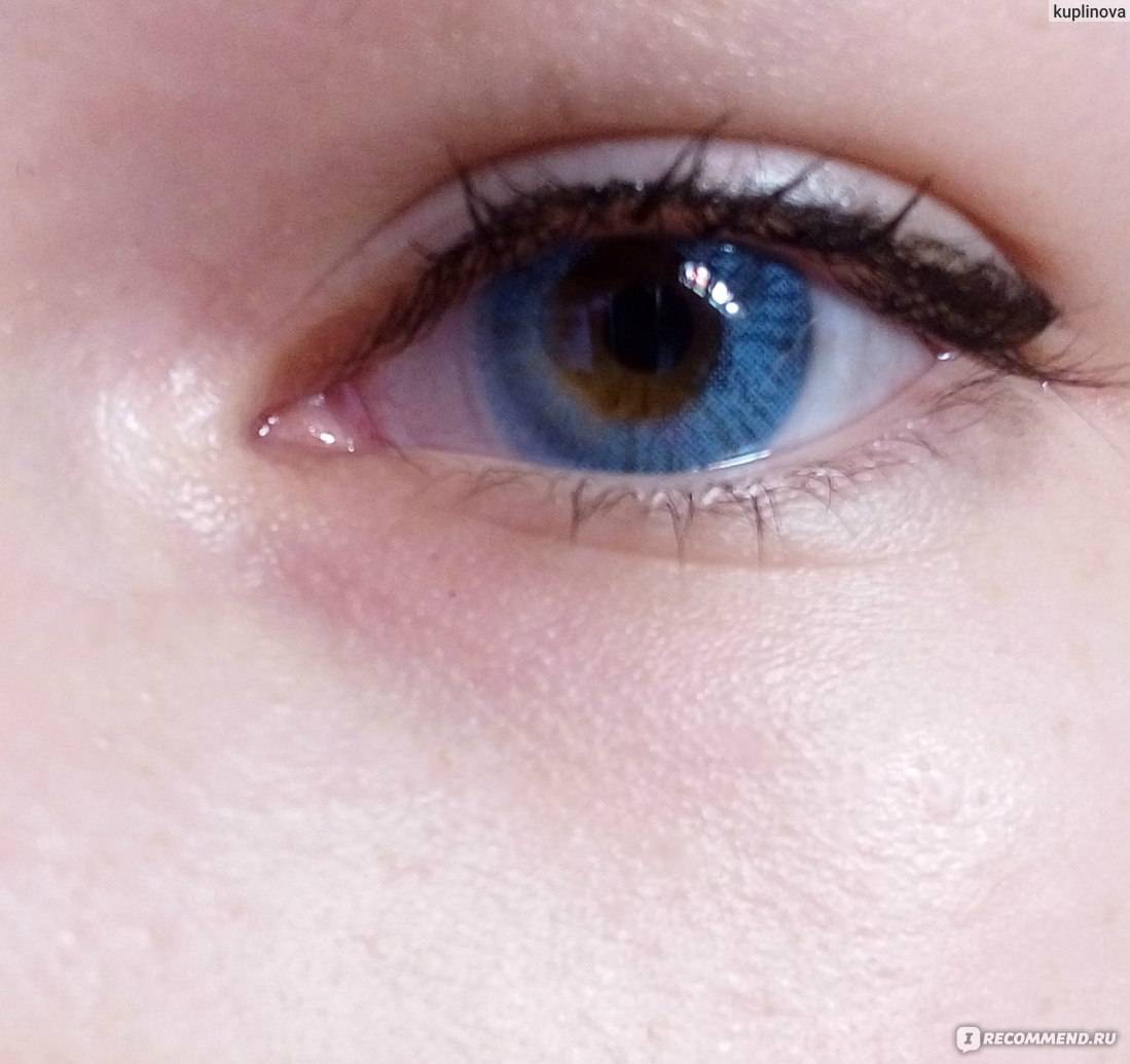 Голубые линзы на карие глаза, правила подбора светлых линз