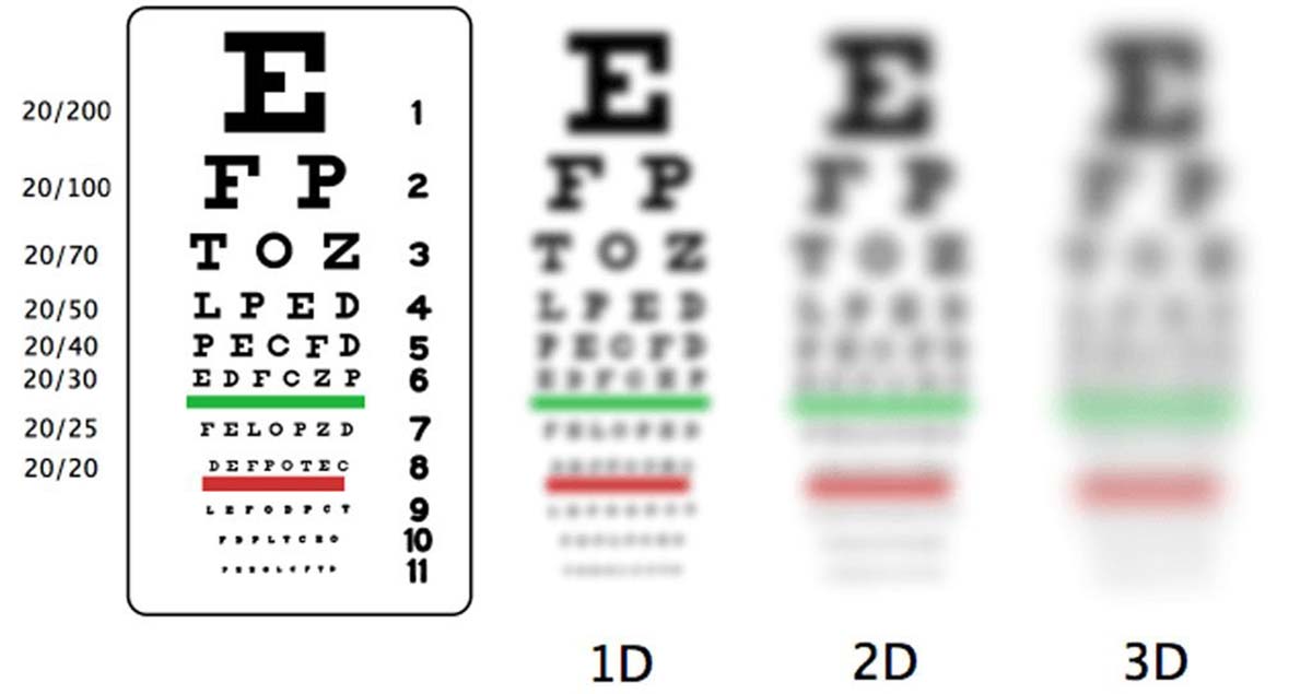 Зрение минус 4 - что это значит, как видит человек, как восставить зрение