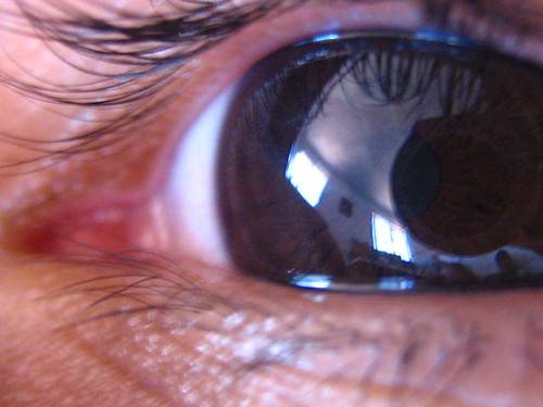 Лечение глаукомы: методы и противопоказания | food and health