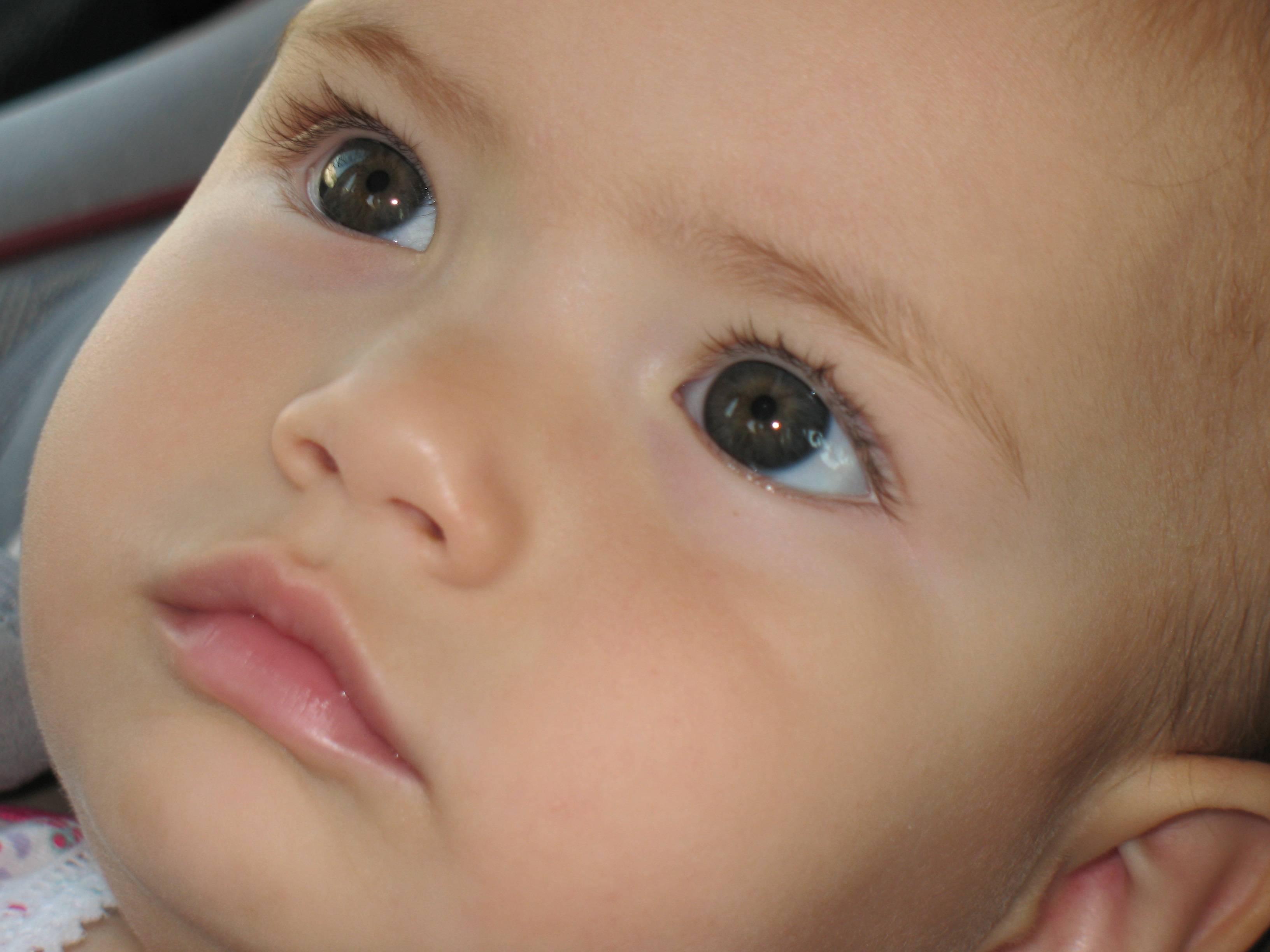 Лопнул сосуд в глазу у ребенка: что делать, если лопнул капилляр у новорожденного, причины и профилактика