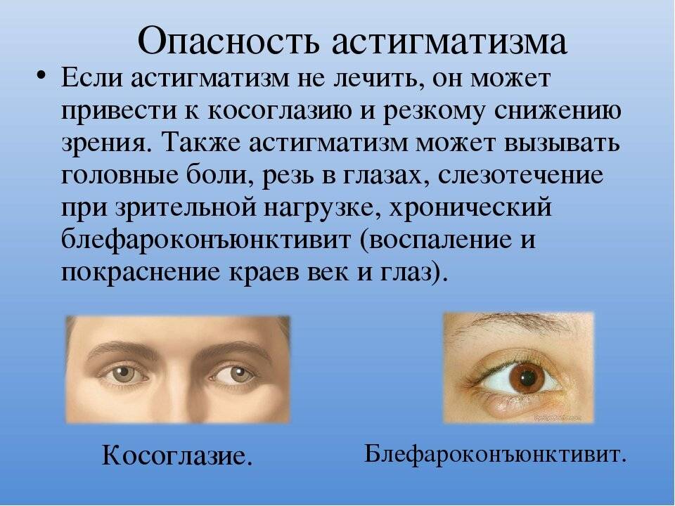 Астигматизм, лечение: лечится это или нет, как лечить глаза, цена коррекции зрения, что такое прогрессирующий, можно ли вылечить