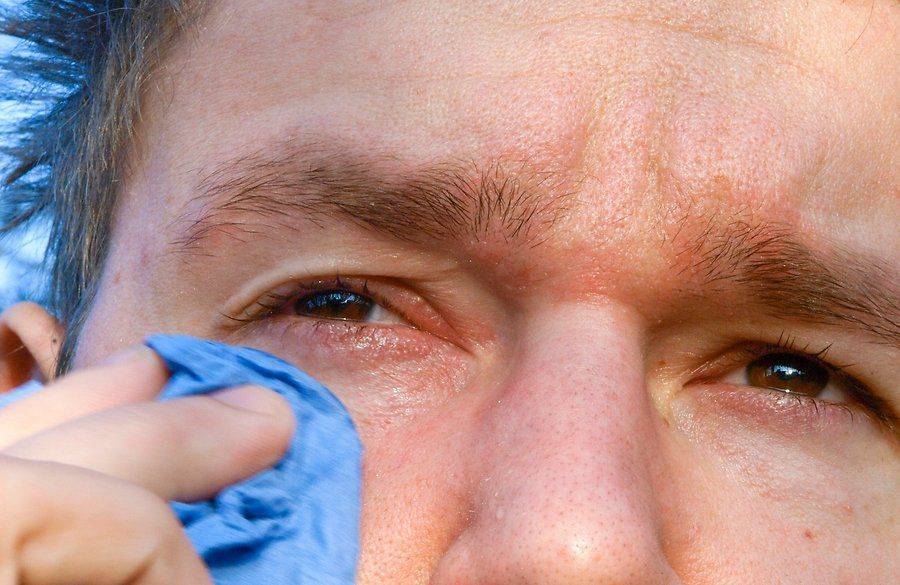 Почему глаза болят после слез что делать