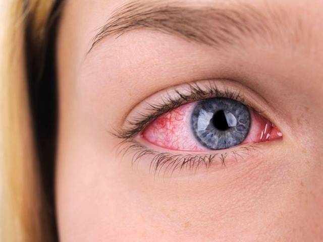 Болят глаза от линз: основные причины боли, что делать