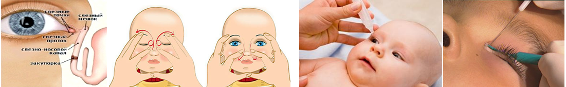 Массаж при дакриоцистите новорожденных: как правильно делать, схема проведения процедуры на глазах, эффект лечения