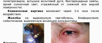 Ожог глаз кварцевой лампой лечение и первая помощь - онколо́гия