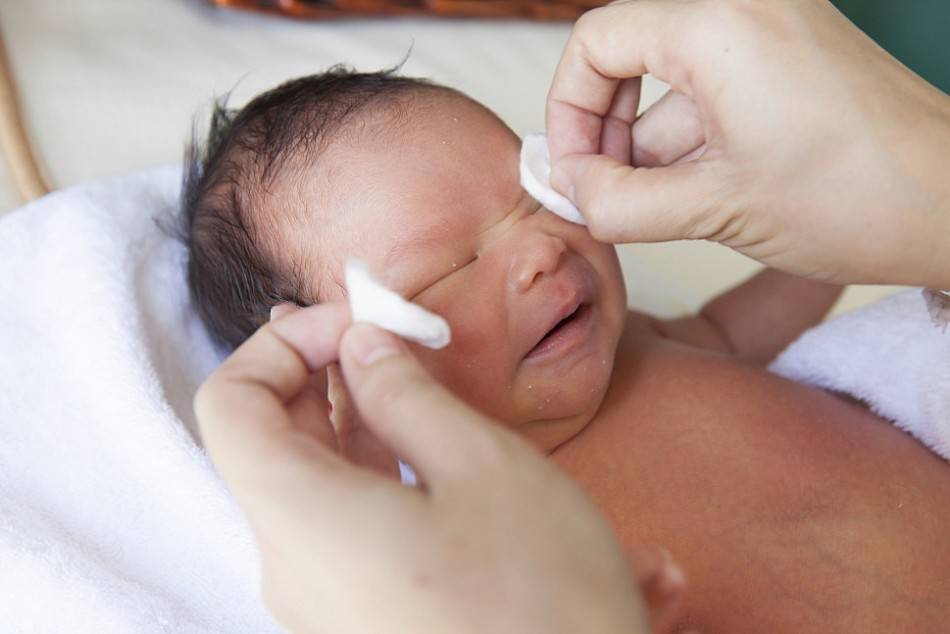 Массаж при дакриоцистите новорожденных - техника выполнения