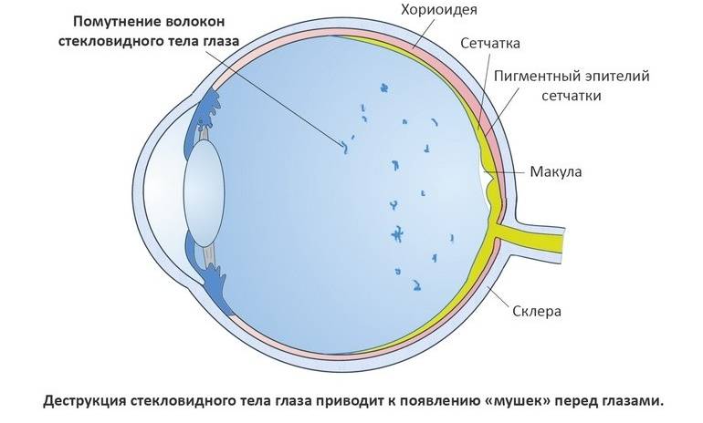 Жёлтое пятно на глазном яблоке: причины, лечение oculistic.ru
жёлтое пятно на глазном яблоке: причины, лечение