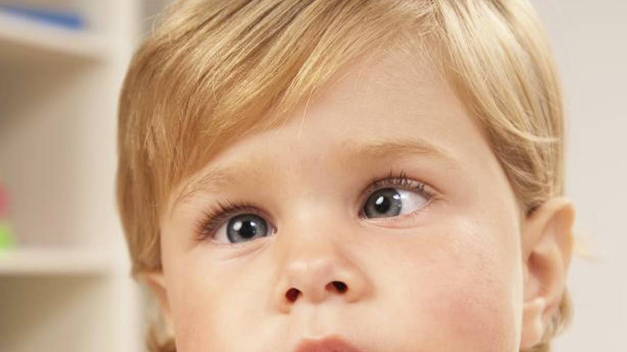 Расходящееся косоглазие у детей: причины и лечение — глаза эксперт