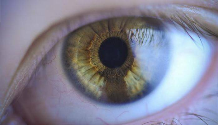 Что означает черная точка на радужке глаза. иридодиагностика - схема радужной оболочки глаза и признаки заболеваний. сигнал от почек