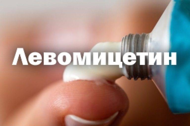 Твои-отзывы.ru - «левомицетин» (глазные капли): цена в аптеках, инструкция по применению, аналоги
