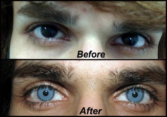 Как может меняться цвет глаз?
