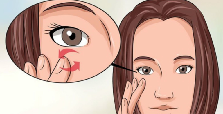 Дергается верхнее веко глаза (миокимия): какие причины и что делать