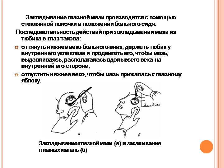 Алгоритм закапывания капель в глаза: пошаговая инструкция :: syl.ru