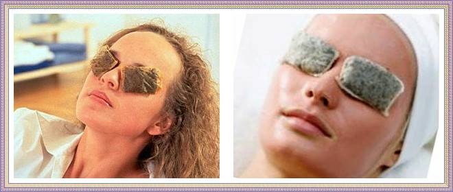 Как быстро убрать синяк под глазом, лечение гематомы от удара и опухоли в домашних условиях за один день, маскировка ушиба