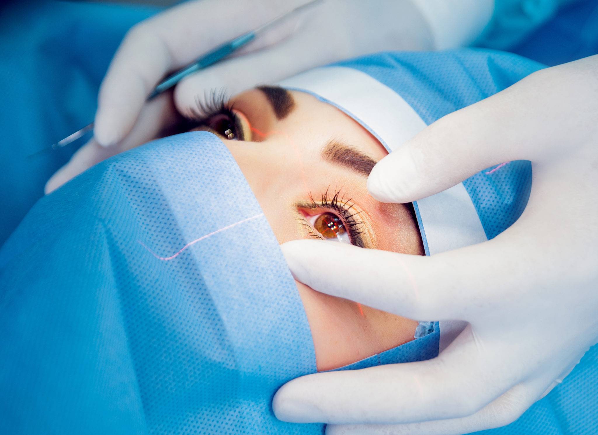 Ограничения после лазерной операции на глаз