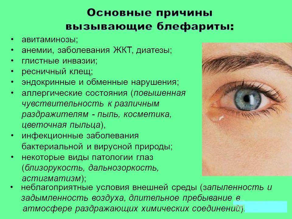 Светобоязнь у детей при каких заболеваниях глаз - причины у ребенка