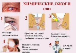 Скорая помощь при болезни глаз. ароматерапия для зрения.