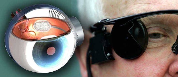 Искусственный глаз для человека: виды протезирования, создание, как вытащить глазной протез