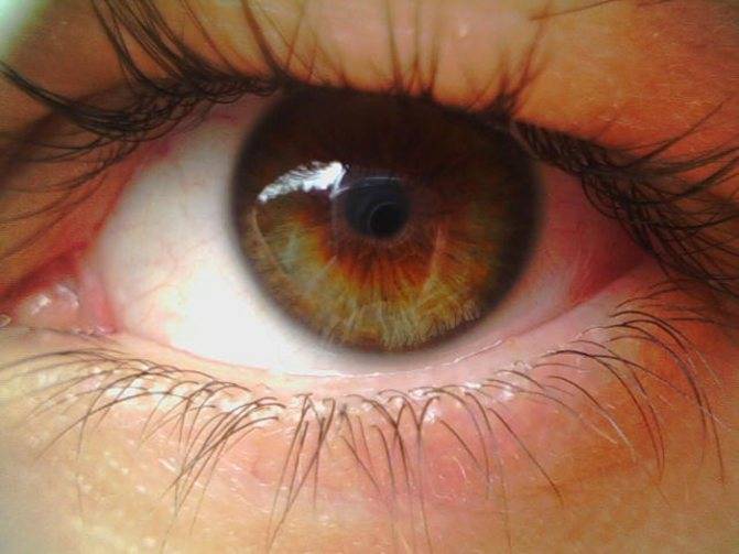 Ожог сетчатки глаза: причины, первая помощь, симптомы, лечение oculistic.ru
ожог сетчатки глаза: причины, первая помощь, симптомы, лечение