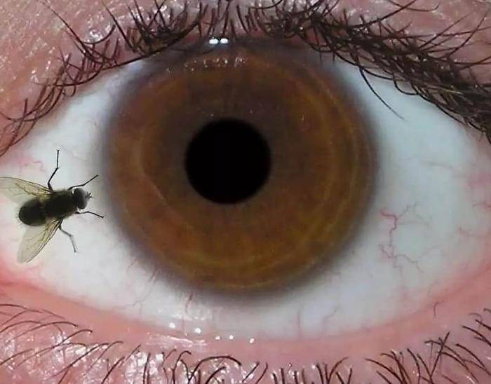Перед глазами плавают черные точки: причины и лечение oculistic.ru
перед глазами плавают черные точки: причины и лечение