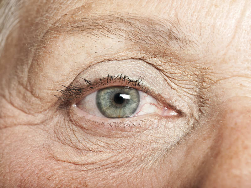 Закрытоугольная глаукома. причины, симптомы, диагностика, лечение и профилактика заболевания.