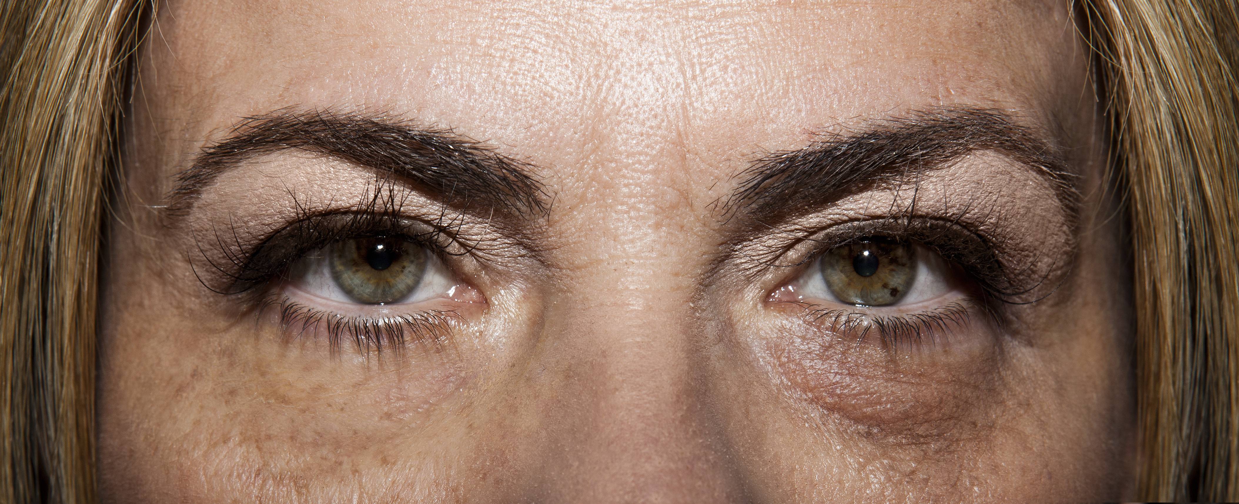 Темные круги под глазами: причины, лечение - "здоровое око"