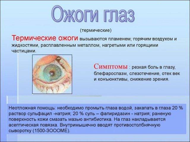 Ожог глаз кварцевой лампой: лечение, симптомы