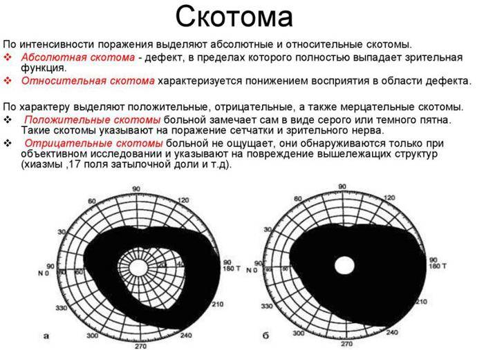 Что такое туннельное зрение и какова его роль oculistic.ru
что такое туннельное зрение и какова его роль