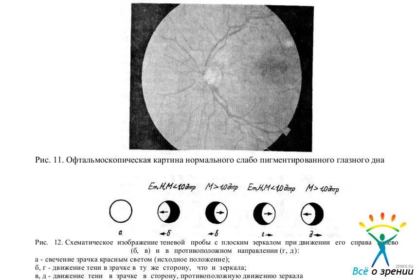 Авторефрактометрия глаза: описание, методика проведения, расшифровка результатов