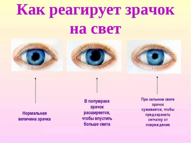 Коррекция зрения - методы. очковая и контактная коррекции
