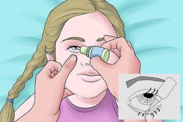 Как правильно закапывать капли в глаза: алгоритм и техника закапывания глазных капель