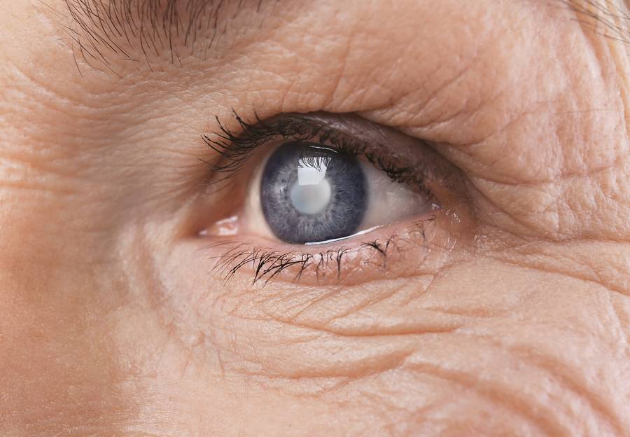 Лечение глаукомы у пожилых людей: причины болезни, препараты и операции для людей в возрасте