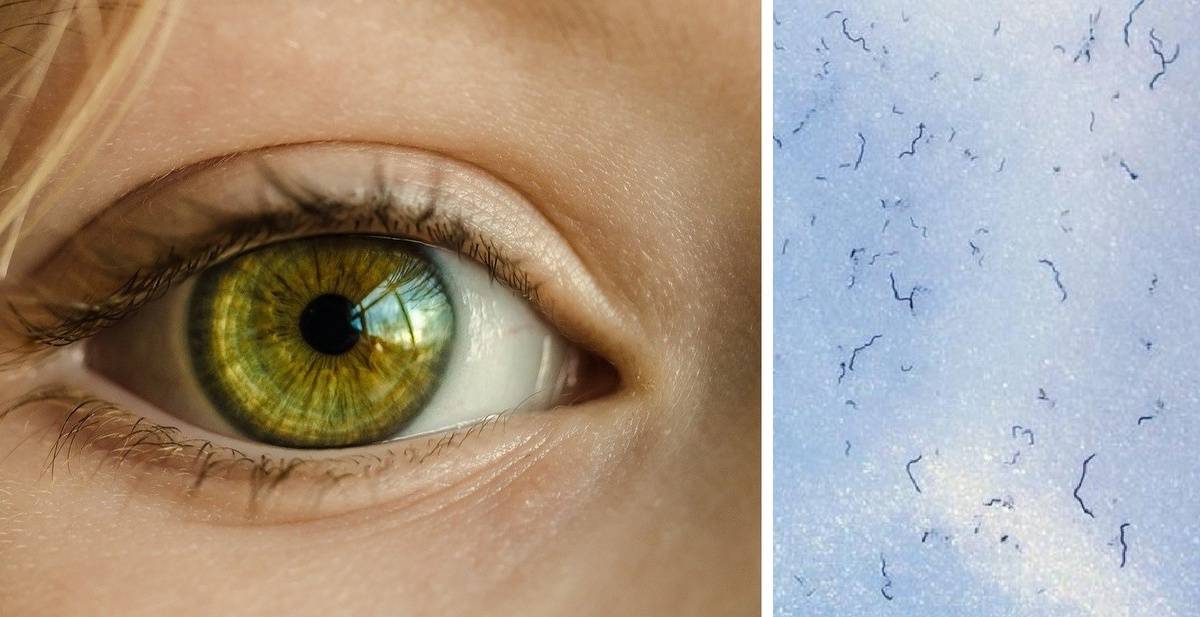 Вспышки в глазах: причины, симптомы и методы лечения - "здоровое око"