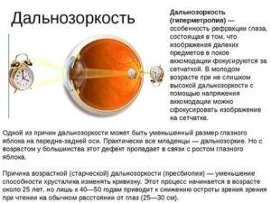 Аметропия глаза у детей и взрослых: что это такое